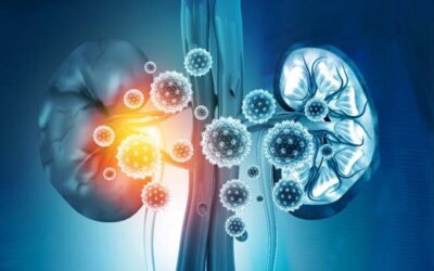 Kidney Disease Management