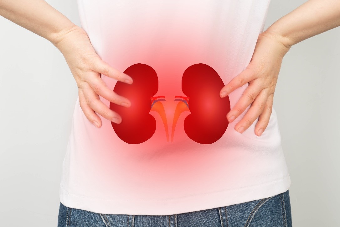 Understanding Nephrotic Syndrome: A Guide to Symptoms, Causes, and Treatment 6