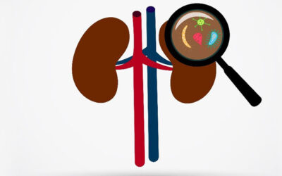 Understanding Kidney Infections (Pyelonephritis): Causes, Symptoms, and Treatment