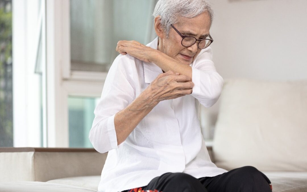 Itching and Kidney Disease: Understanding the Link Between Your Skin and Kidney Health