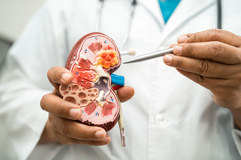 kidney-inflammation-img