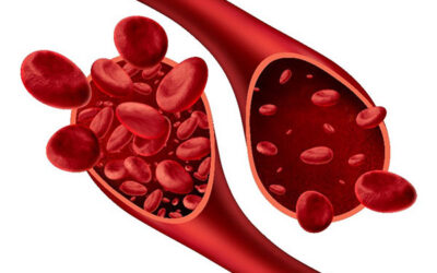 High Blood Pressure & Kidney Disease